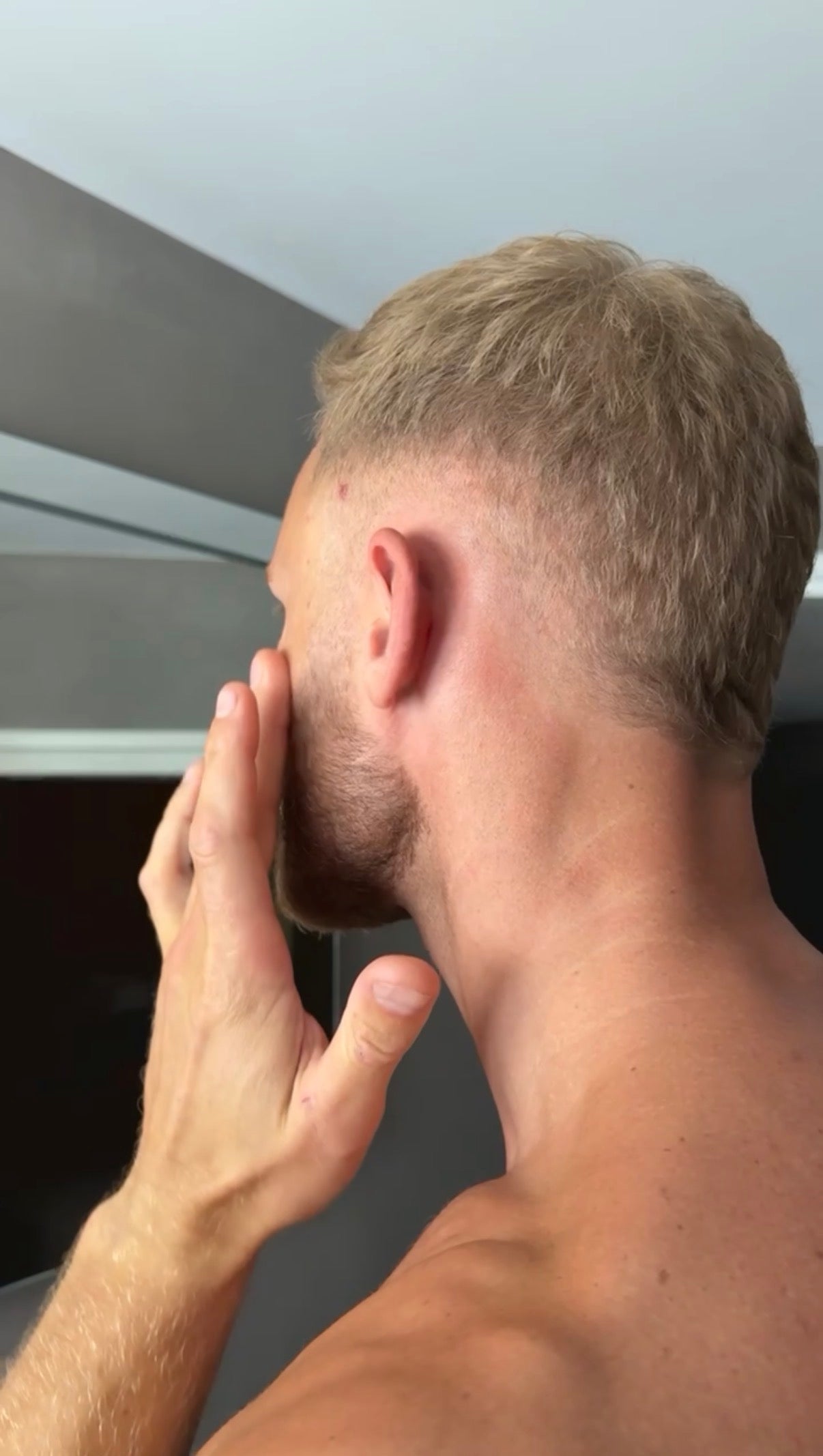 Leven zonder eczeem, terug naar de oorsprong van een gezonde huid